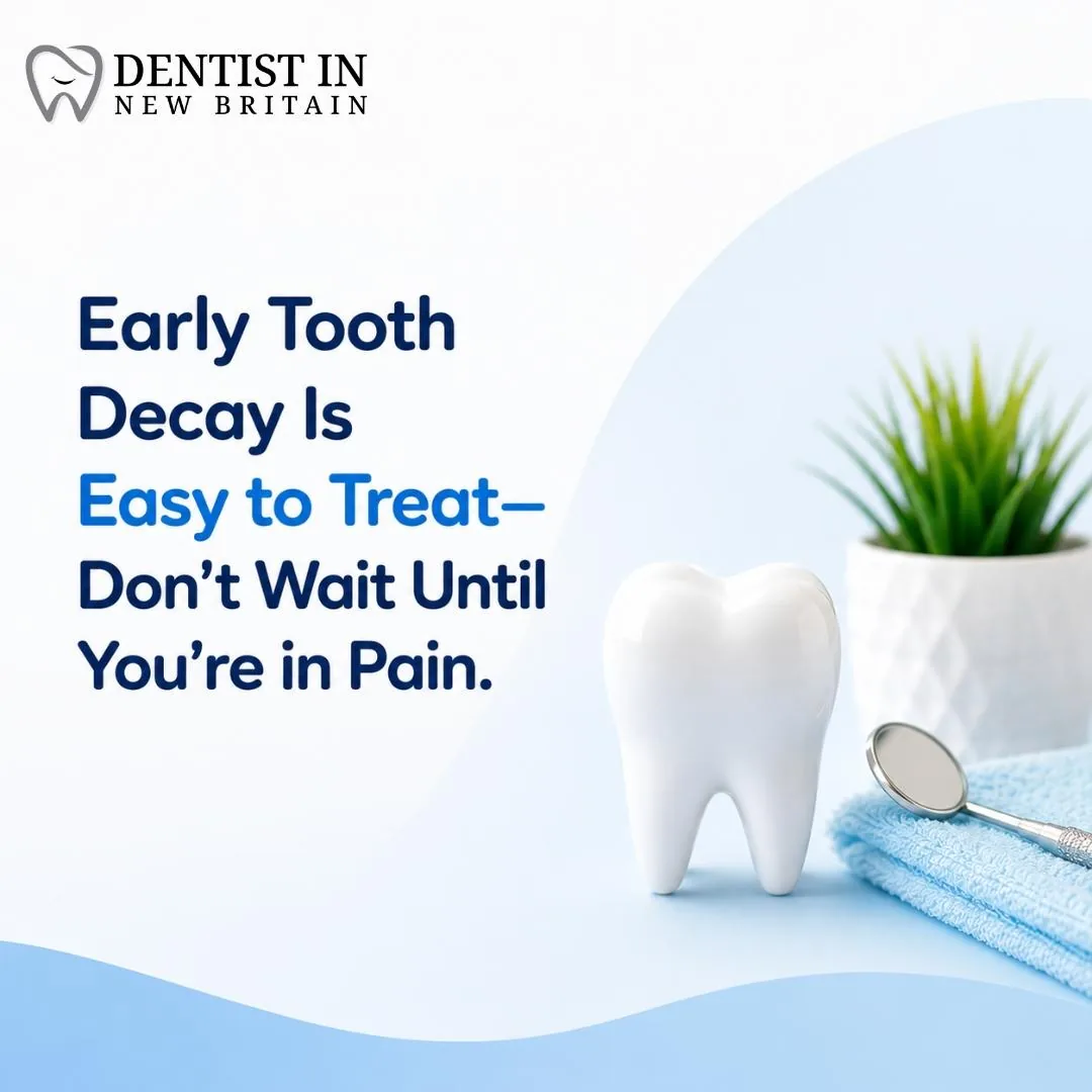 Early Tooth Decay Is Easy to Treat—Don't Wait Until You're in Pain