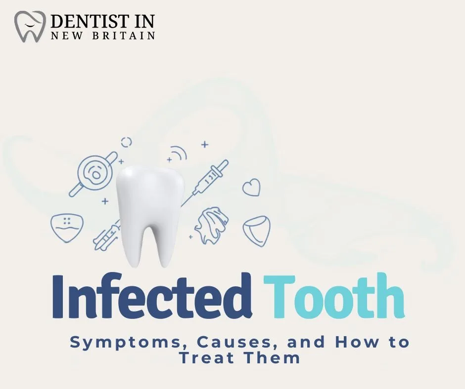 Infected Tooth Symptoms, Causes, and How to Treat Them