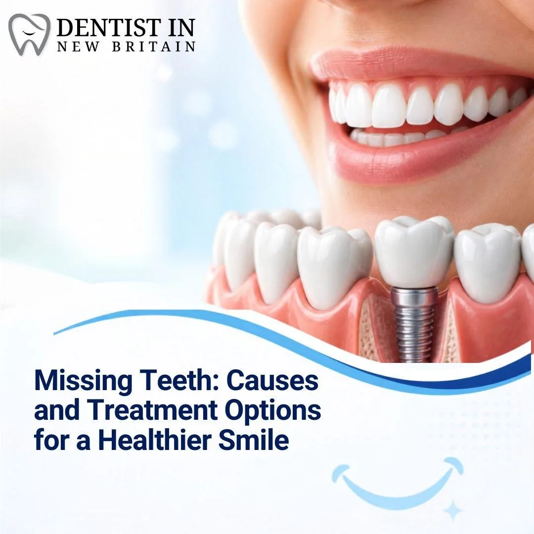 Missing Teeth: Causes and Treatment Options for a Healthier Smile